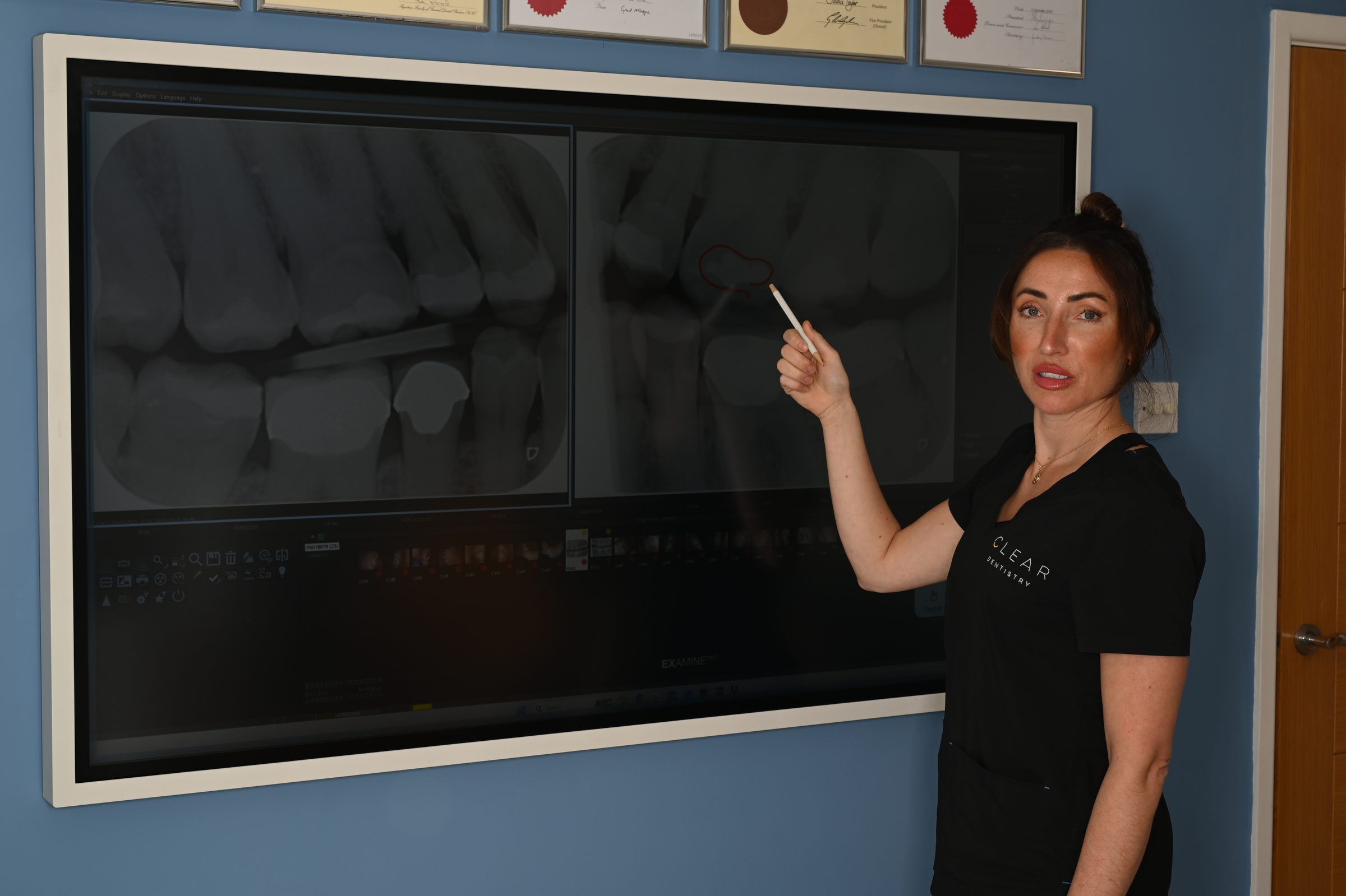 Cherrish Collins explaining X-rays on screen