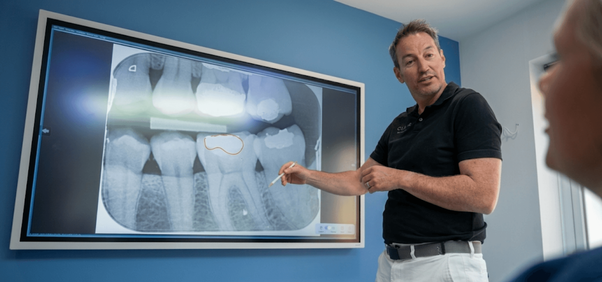 A dentist explaining a radiograph to a patient on a large screen
